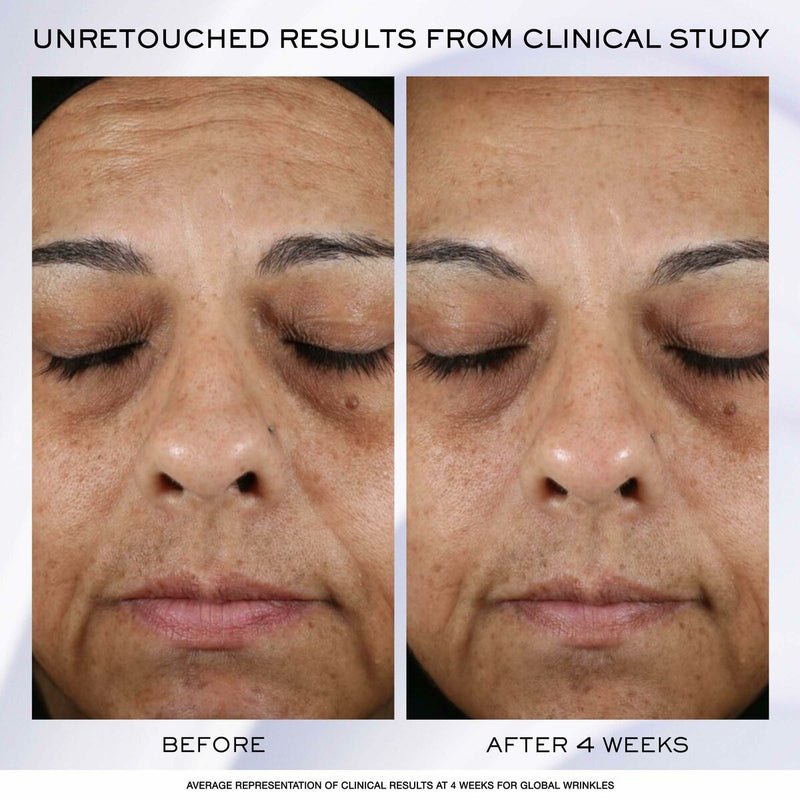 Lataa kuva gallerian katseluohjelmaan V3HBBDABF4557BD9CED52DFA459CC7FAE5BR5608209P2
